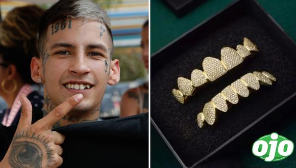 L-Gante presume su nueva dentadura postiza hecha de oro y diamantes | Imagen compuesta 'Ojo'