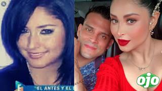 Todas las cirugías de Pamela Franco: “tenía la nariz que le llegaba a Chimbote”, revela doctor que la atendió 