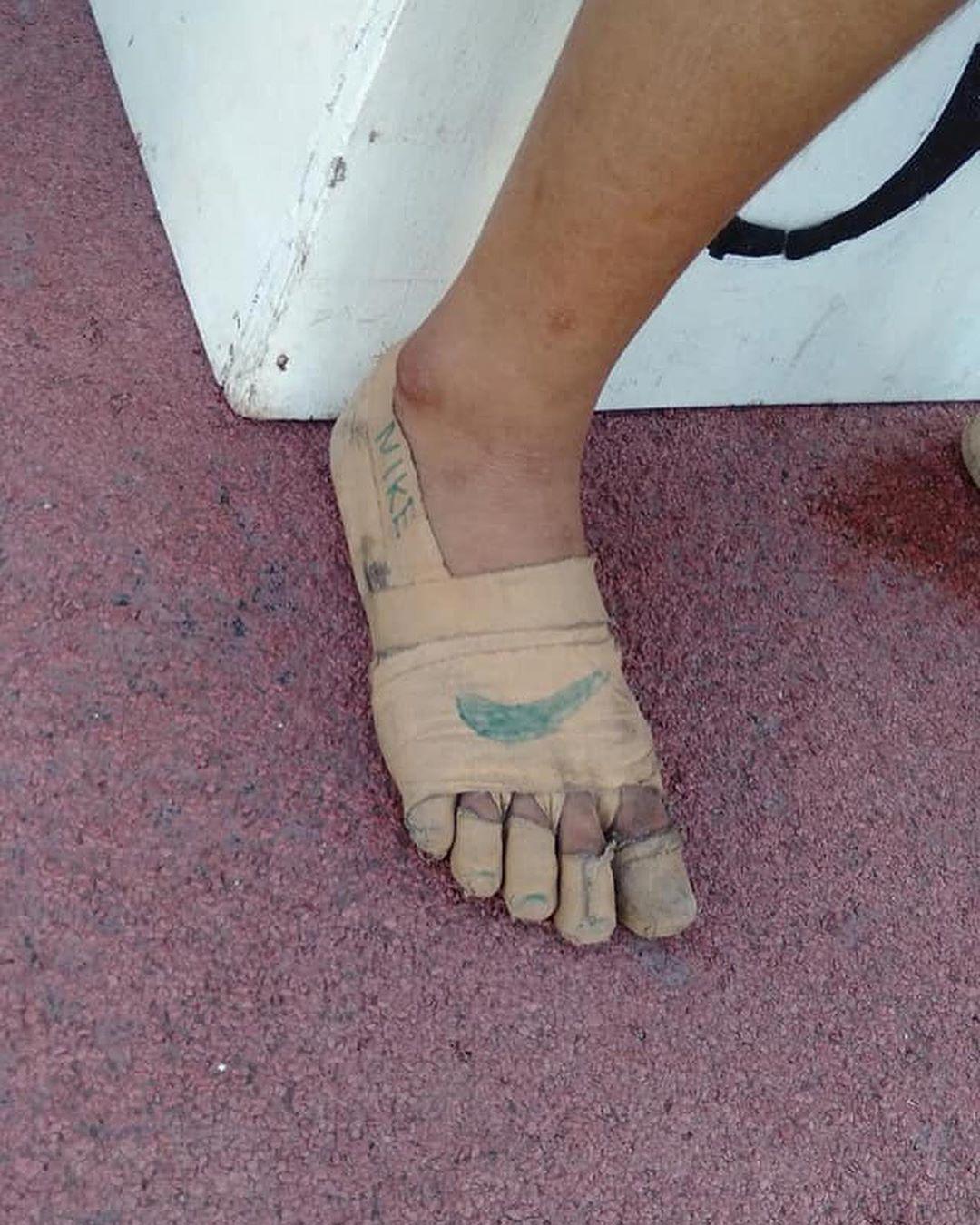 La menor pintó sus vendas como si se tratara de una zapatilla profesional. (Foto: @rheabullos)