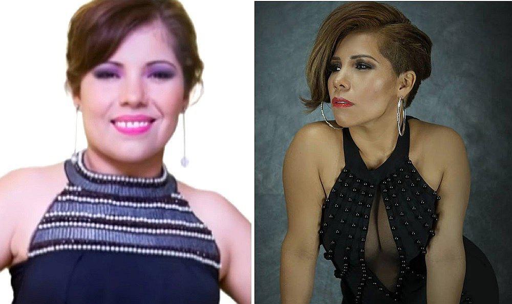 Conoce las tres cirugías plásticas que se realizó Susan Ochoa│VIDEO