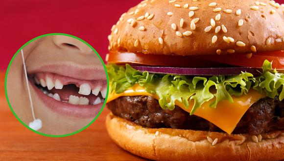 Comensal encuentra un diente humano en conocida cadena de hamburguesas