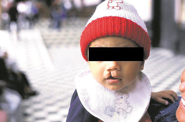 Operación Sonrisa realizará operaciones gratuitas para menores