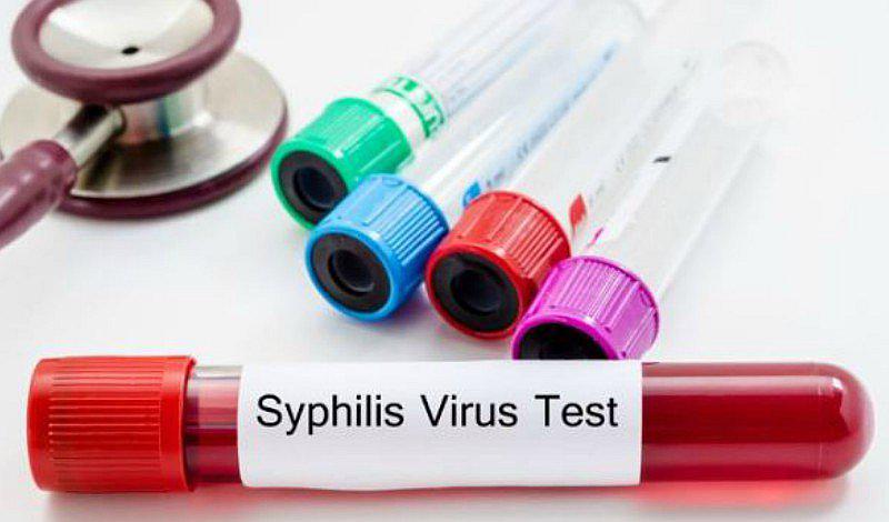 Entérate qué ETS se transmite mediante los besos