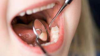 YouTube: mujer va al dentista y le encuentran algo asqueroso entre los dientes