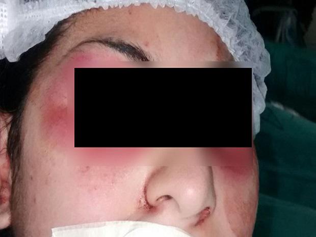 ​Argentina: Violaron a menor y le sacaron los ojos en rito satánico