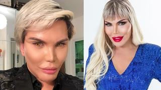 ‘Ken humano’, Rodrigo Alves, ahora quiere ser ‘Barbie’ y presume su nueva imagen como mujer 