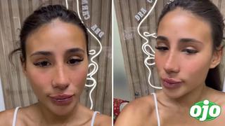 Samahara Lobatón y sus nuevos retoques en la cara con canje