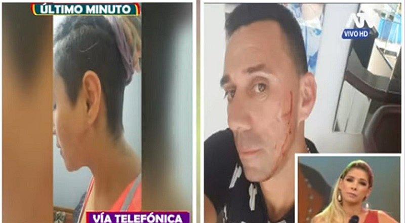 ​Miguel Rebosio: expareja lo acusa de agresión y de haber hecho lo peor (VIDEO)