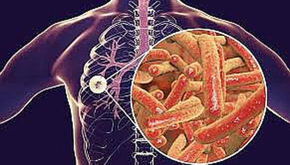 ​Cura para la tuberculosis estaría en toxina suicida de la misma bacteria