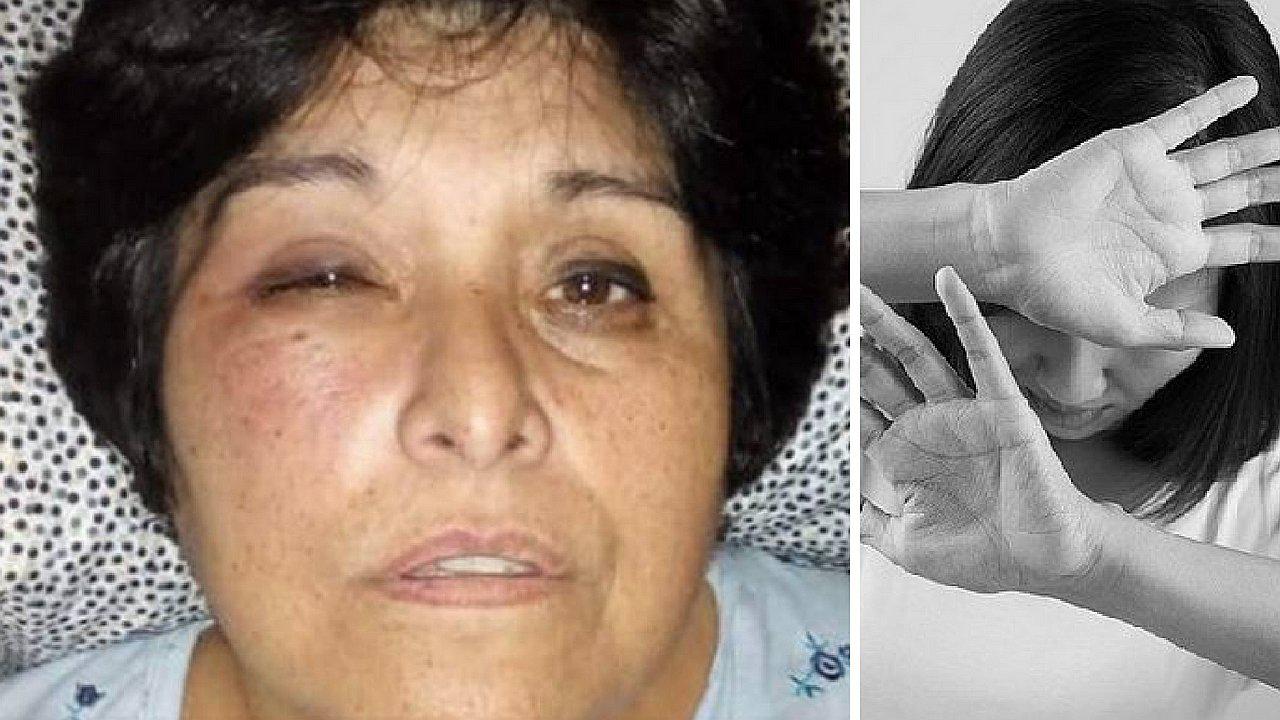 Padre y alumno agarran a puñetes a profesora con discapacidad motora (FOTOS)