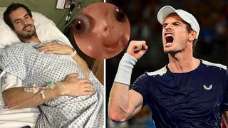 El terrible descuido en la radiografía de famoso tenista, Andy Murray 