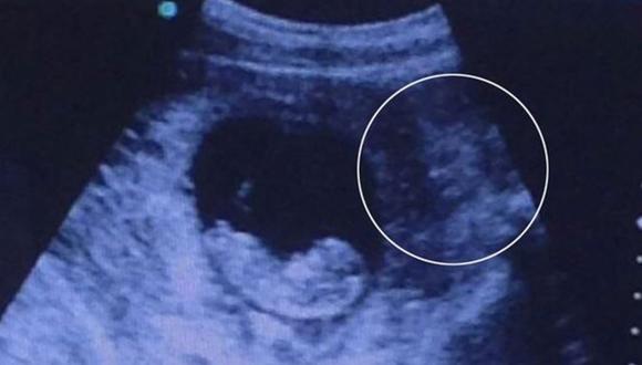 Polémica por ecografía que muestra a "demonio vigilando un feto" [FOTOS]