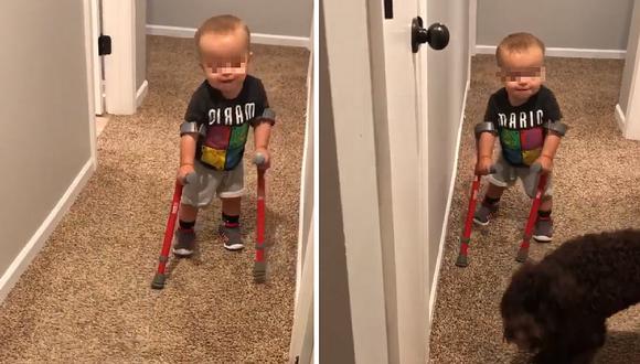 La conmovedora historia de este niñito que da sus primeros pasos con sus muletas