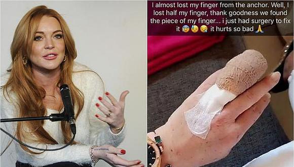 Lindsay Lohan perdió parte del dedo en un accidente de bote [VIDEO]