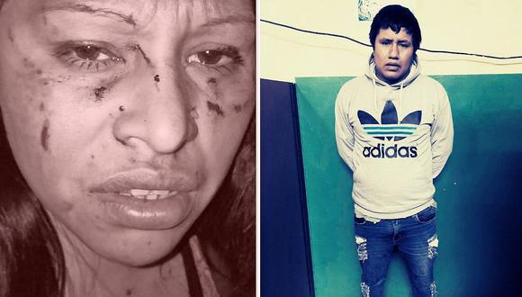 Mujer termina con el rostro desfigurado tras ser atacada por el padre de su hija y su nueva pareja 