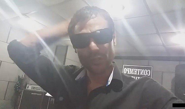 ​Muestran a cantante de 6 voltios desfigurado y hacen grave denuncia (FOTO)