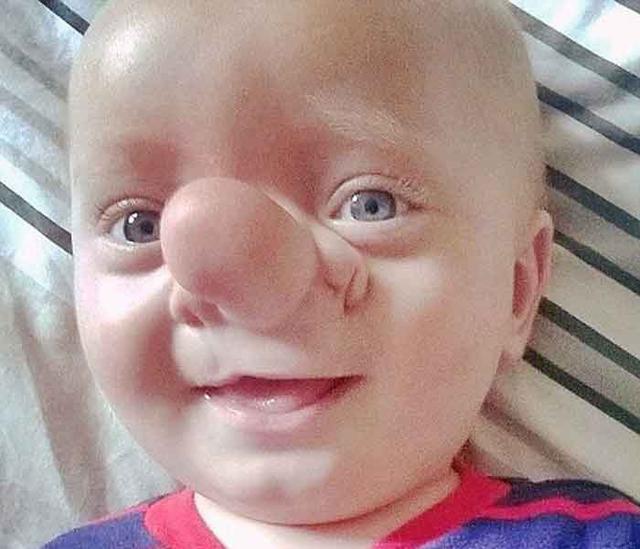 ​Esta es la conmovedora historia del "pinocho de la vida real" [FOTOS]