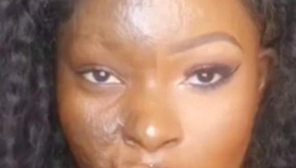 ¡Gran ejemplo de mujer! Víctima de quemaduras te impresionará con su maquillaje [VIDEO]