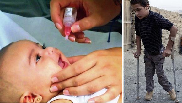 Polio: ¿Cuándo fue la última vez que apareció en el Perú?