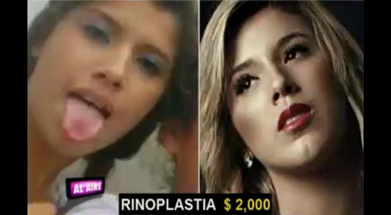 ​Yahaira Plasencia: ¿Cuántos miles de dólares gastó en cirugías? [VIDEO]