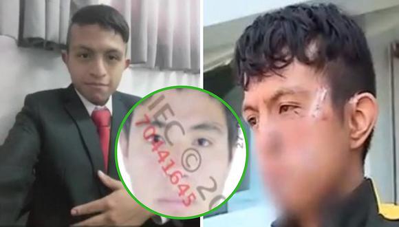 Familiares de delincuente piden que lo liberen luego de desfigurar rostro a joven en asalto 