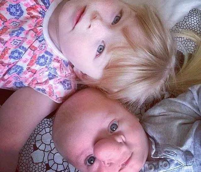 ​Esta es la conmovedora historia del "pinocho de la vida real" [FOTOS]