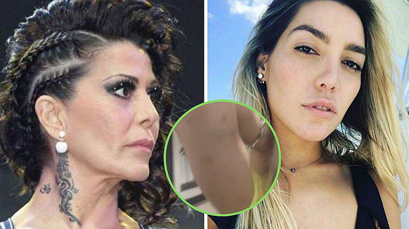 Frida Sofía muestra las marcas de los golpes que le habría hecho Alejandra Guzmán | VIDEO