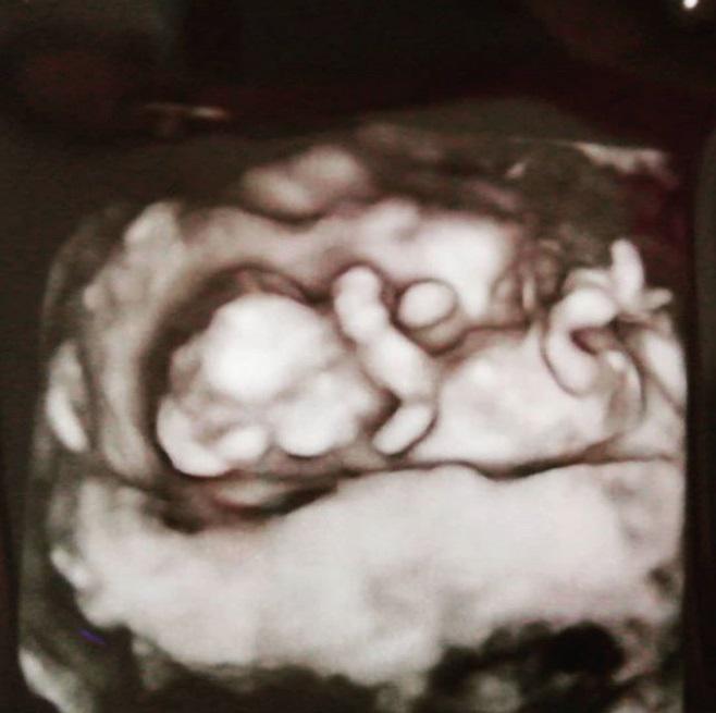 Foto: Instagram Daniela Cilloniz