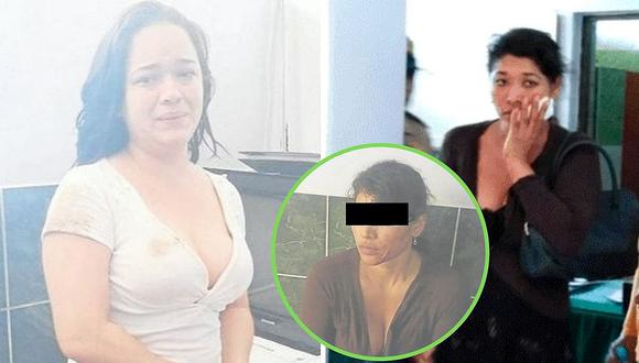 Mujer reclama a venezolana por mensajes a su pareja y esta la habría desfigurado│FOTOS