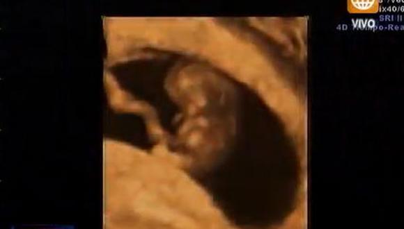 Sully Sáenz mostró la primera ecografía de su bebé [FOTO] 