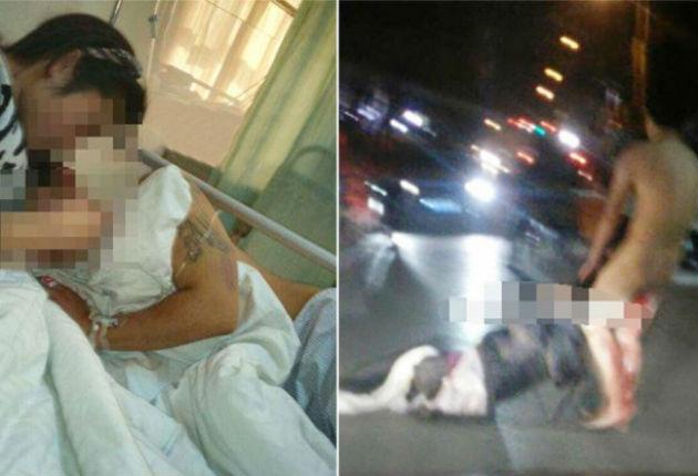 Mujer le corta pene a infiel y tras ser reconstruido lo vuelve a mutilar