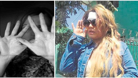 Chiclayo: sujeto desfigura a mujer de 22 años por esta insólita razón  