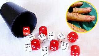 Se implanta imanes en los dedos para hacer trampa y ganar al jugar con los dados