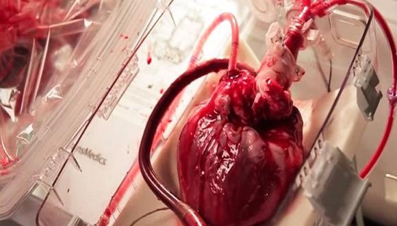 ​YouTube: médicos presentan dispositivo que revive un corazón muerto