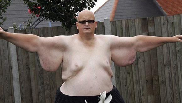 Hombre que fue el más gordo del mundo baja 300 kilos