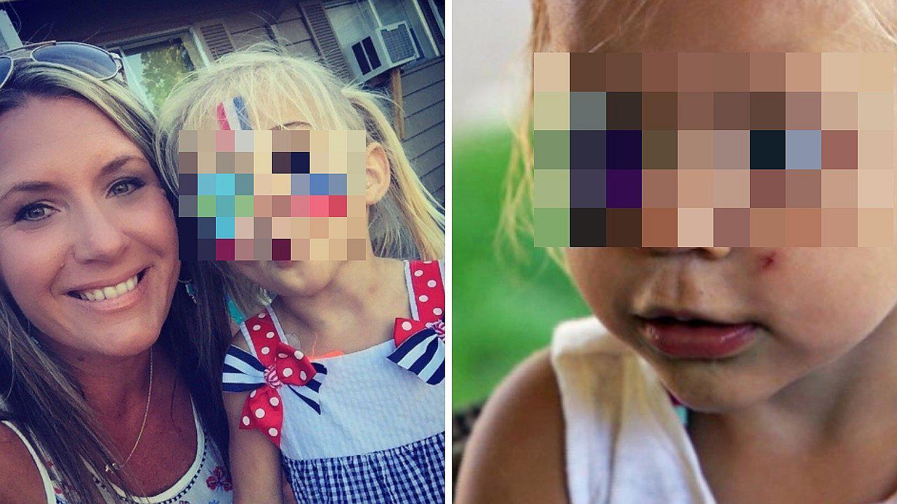 Mamá observa brillo peculiar en el ojo de su hija y le diagnostican 11 tumores malignos 