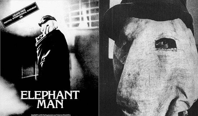 ¿Quién fue el hombre elefante? ¡Entérate de todos los detalles! 