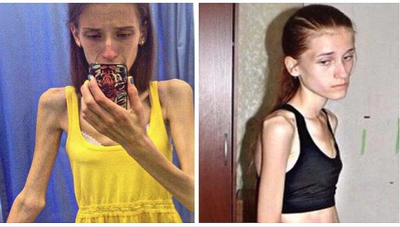 Instagram: mujer que pesaba solo 30 kilos, se recupera y luce cuerpazo (FOTOS) 