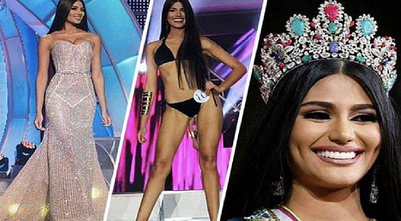 Sale a la luz fotos de Miss Venezuela Sthefany Gutiérrez antes de sus cirugías 