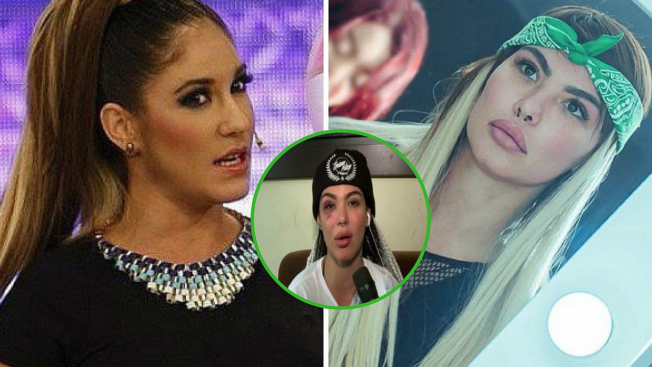 Tilsa Lozano opina por primera vez sobre agresión sufrida por Angie Jibaja 