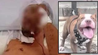 Entró a robar a una casa pero es atacado por pitbull y ¡pierde un brazo! (VIDEO)