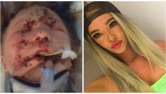  Facebook: La sorprendente transformación de una joven que tenía el rostro desfigurado [FOTOS]