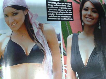 Aparecen más fotos de Karen Schwarz antes de sus cirugías