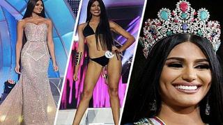 Sale a la luz fotos de Miss Venezuela Sthefany Gutiérrez antes de sus cirugías 