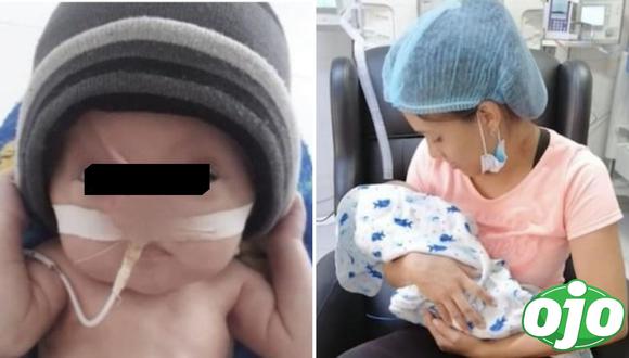 Emiliano, el bebé que nació sin nariz, labios y paladar. Foto: (redes sociales).