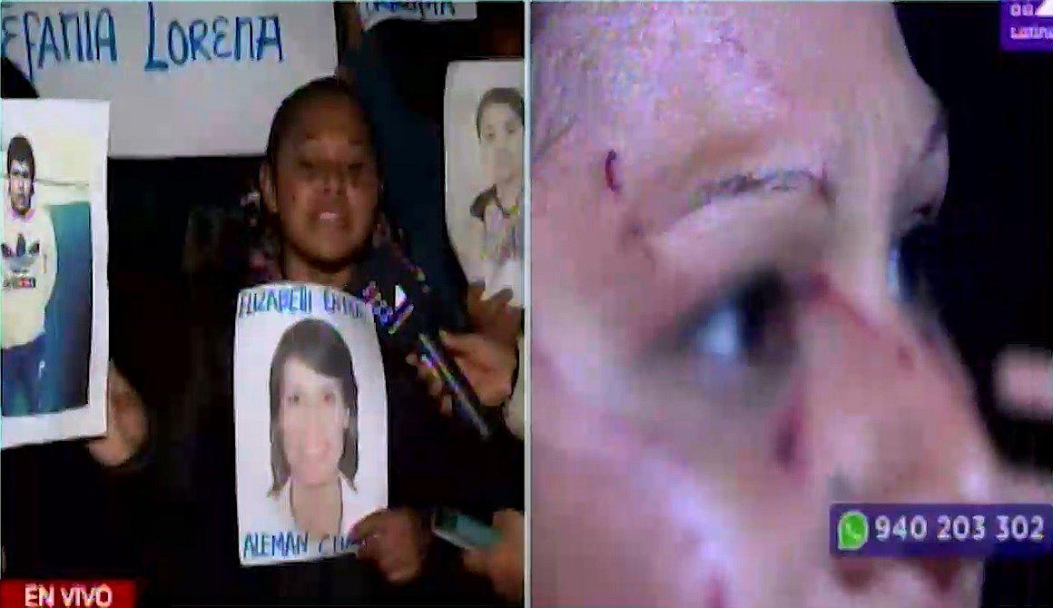 ​Hombre y su nueva pareja desfiguran a madre de familia y jueza lo deja en libertad | VÍDEO