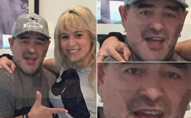 Diego Maradona: Así luce el 'Pelusa' tras operación al rostro