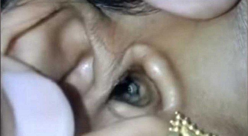 Despertó con fuerte dolor de cabeza, fue al hospital y hallaron algo espantoso en su oído (VIDEO)