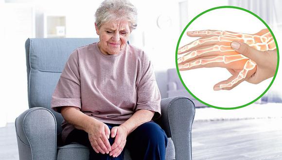 Osteoartritis, una enfermedad que afecta al 80% de personas mayores de 75 años
