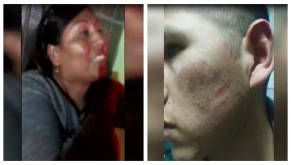 Dani Marina López Mamani es la mujer que agredió al policía durante operación de fiscalización. (Captura: América Noticias)